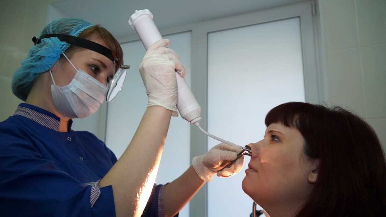 Операции на носовых раковинах в клиническом госпитале на яузе