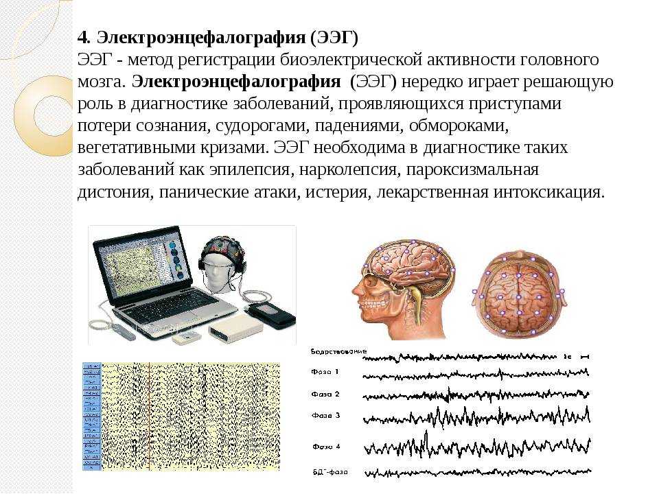 Характер изменений биоэлектрической активности мозга. Электроэнцефалография головного мозга (ЭЭГ). ЭЭГ головного мозга методика проведения. ЭЭГ схема физиология. Методика снятия ЭЭГ.