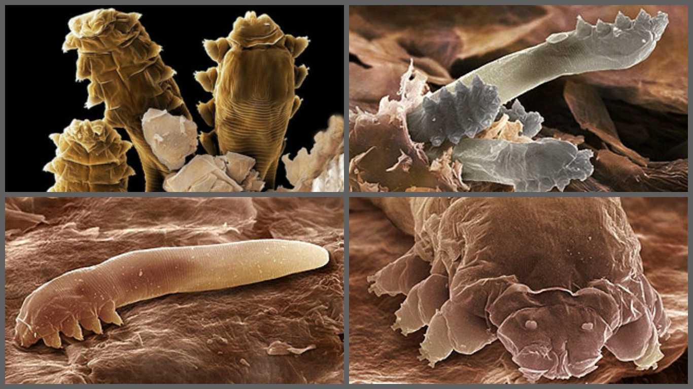 Почему важно делать исследование кожи и ресниц на наличие клеща демодекс? | сехмет - медицинская лаборатория, г.сумы