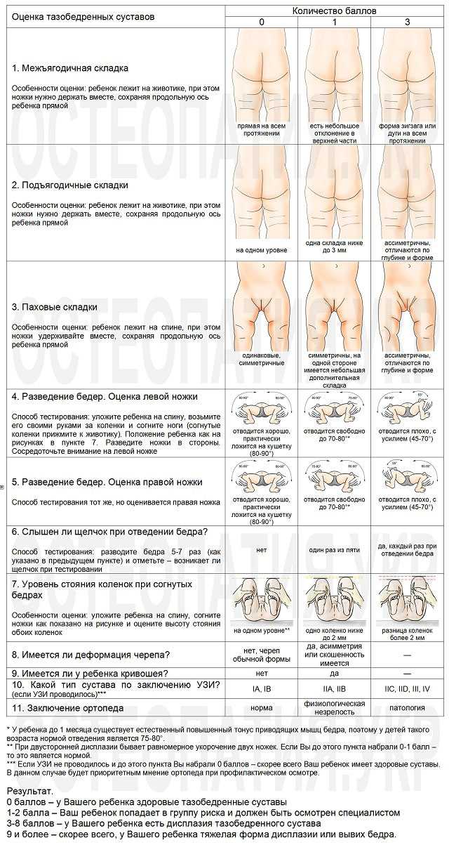 Дисплазия тазобедренных суставов, симптомы и лечение дисплазии тазобедренных суставов в клинике цэлт.