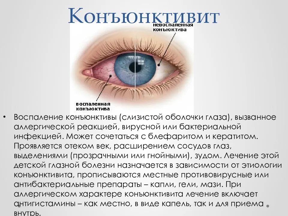 Заболевания глаз биология 8. Глазные болезни список заболеваний и симптомы у детей. Глазные болезни список заболеваний у человека. Заболевание глаз перечень заболеваний. Коньюктивит коньюктивит коньюктивит.