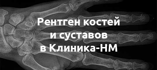 Рентген костей и суставов в клинике "ниармедик"