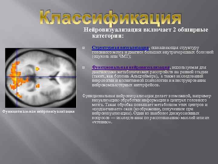 Что собой представляет магнитно-резонансная спектроскопия Показания к процедуре: эпилепсия, ишемическая болезнь, болезнь Альцгеймера Области применения МРС и противопоказания