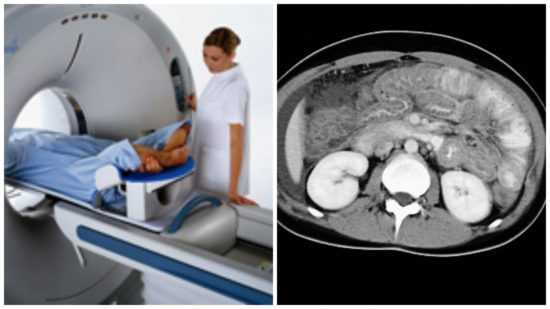 Компьютерная томография: что это за метод диагностики. виды мскт-исследований