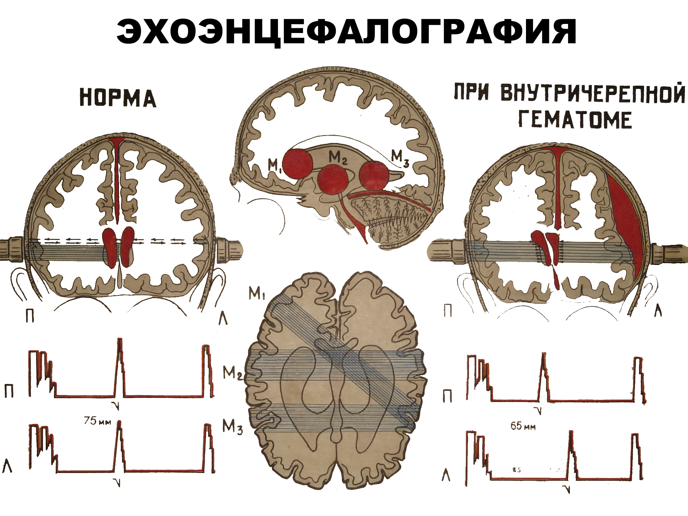 Исследование головного мозга ребёнка — медицинский центр «целитель»