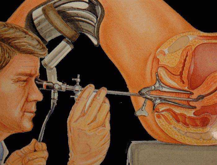 Что такое гастроскопия: подготовка, обезболивание, ход процедуры * клиника диана в санкт-петербурге