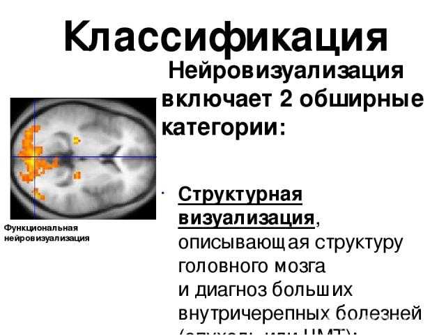 Магнитолазерная терапия (млт) в неврологии. лечение болей, остеохондроза, туннельных синдромов, невралгии