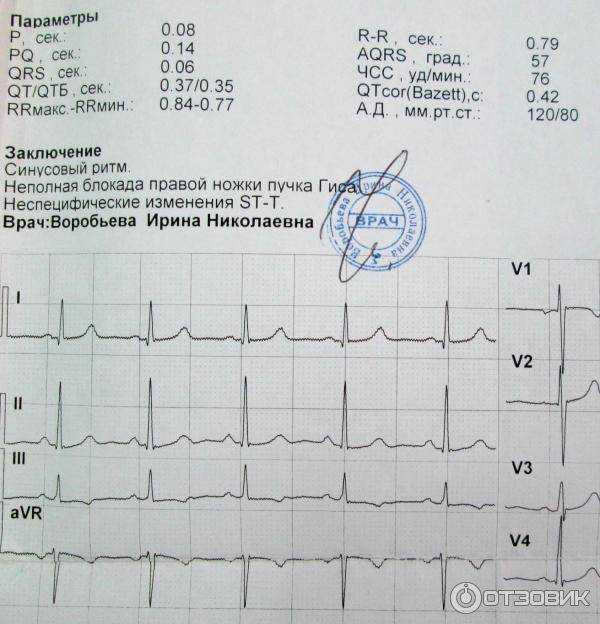 Коронарография сосудов сердца: что это, и когда проводят процедуру?
