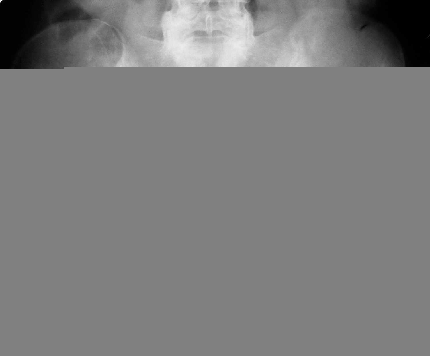 Рентген (рентгенография) костей таза: суть метода, подготовка | food and health