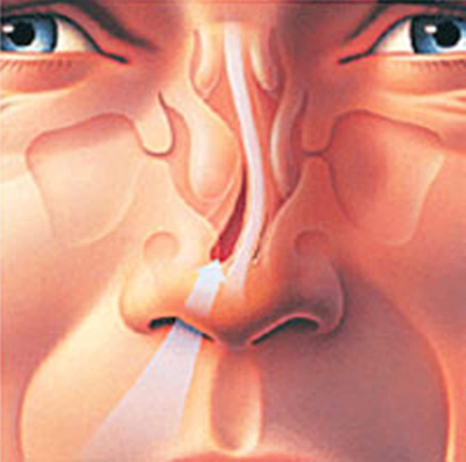 Операции в области носа