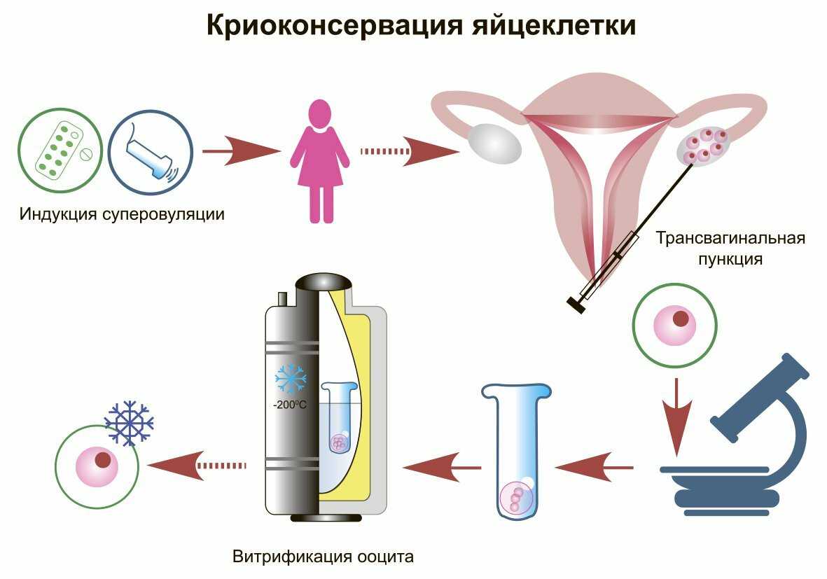 После переноса эмбрионов: когда он должен прижиться в матке
