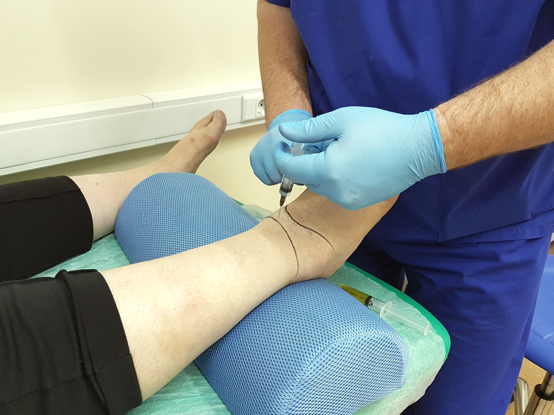Обезболивающая противовоспалительная блокада колена: что это такое?