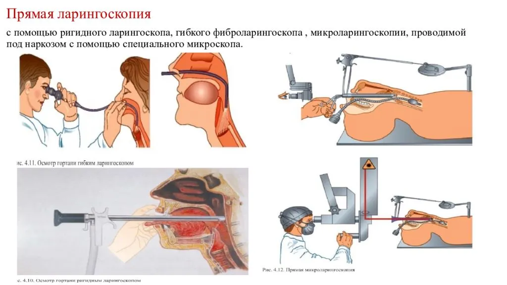 Лечение опухолей средостения в международной клинике медика24