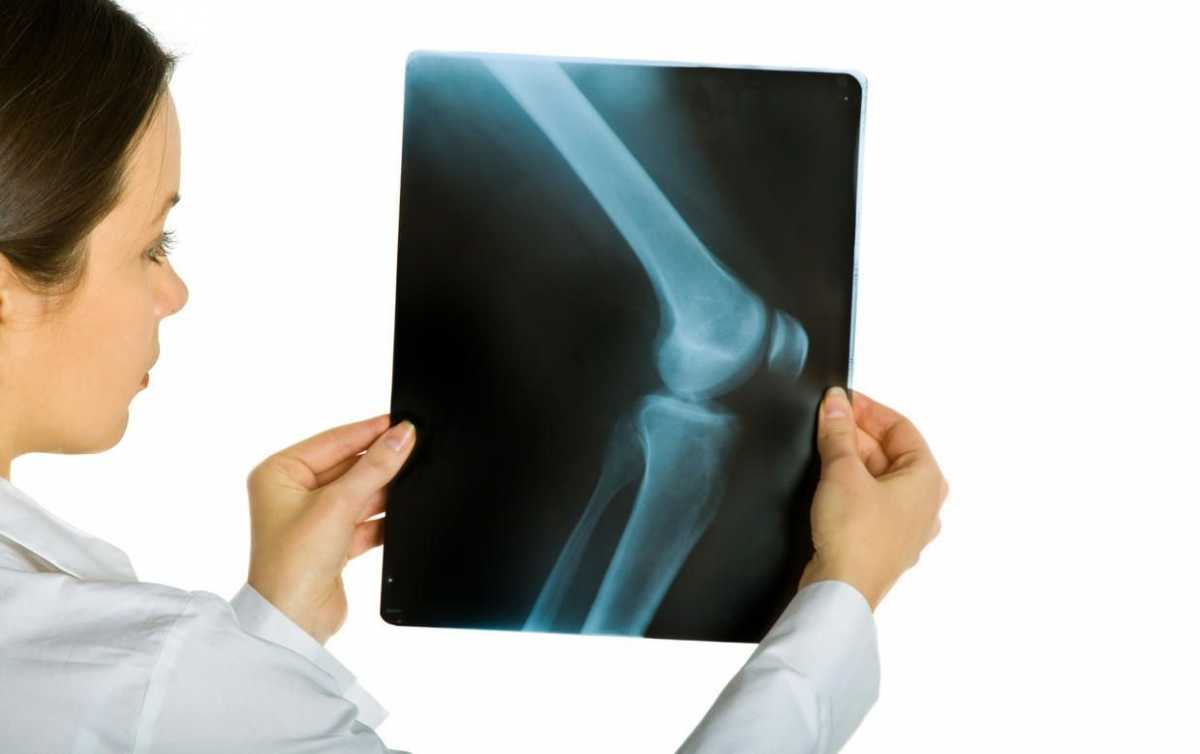 Рентген тазобедренного сустава: подготовка и проведение в отличии от мрт