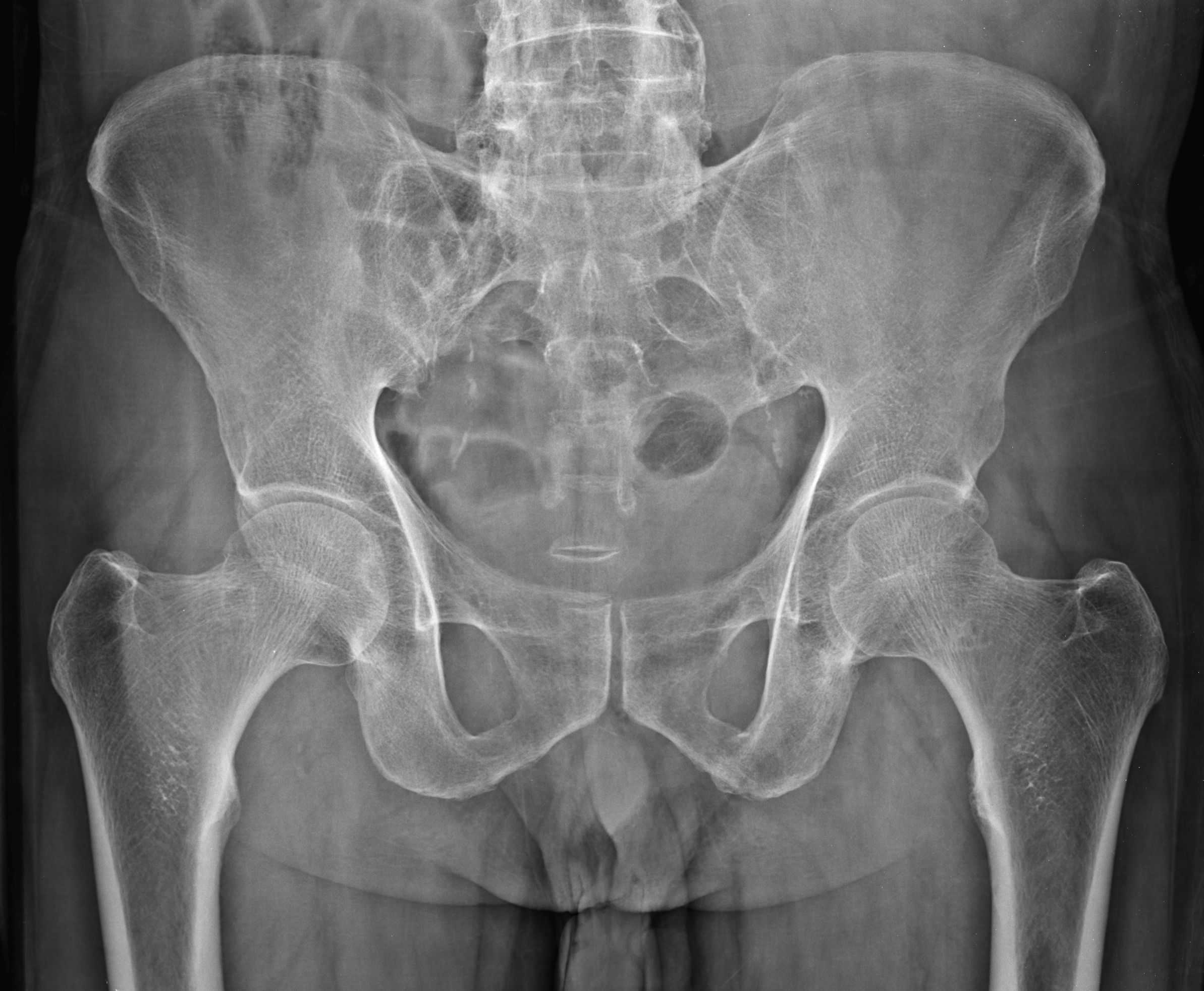 Рентген костей таза: как делают, что показывает рентген, противопоказания