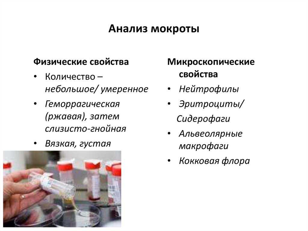 Микроскопическое исследование мокроты: бактериологический анализ, метод сбора, расшифровка, норма лейкоцитов