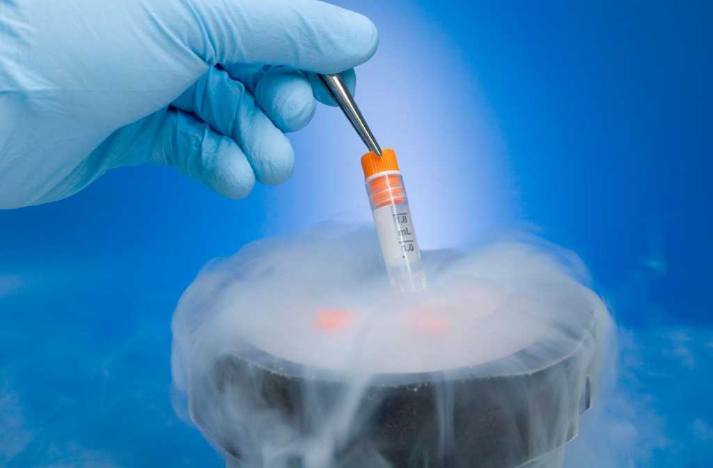 Правила проведения криоконсервации эмбрионов Пошаговый алгоритм и сроки хранения образцов Стадии развития материала для заморозки: бластоцисты, восьмиклеточные, оплодотворенная яйцеклетка