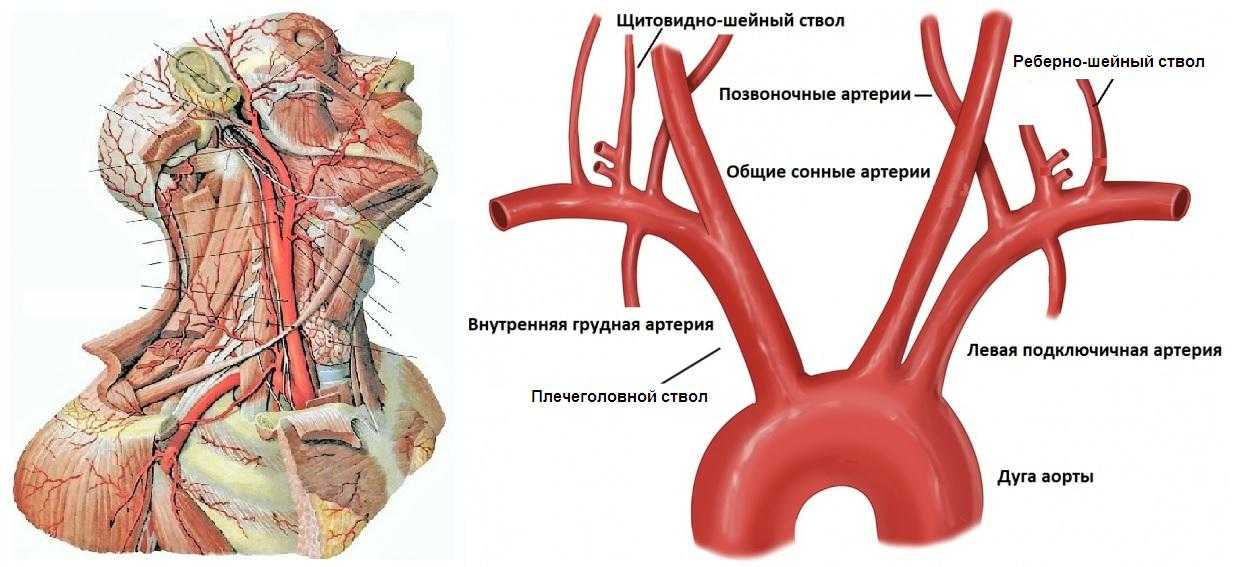 Схема брахиоцефальных артерий
