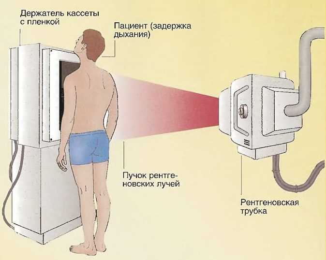 Рентген грудной клетки: что показывает, как проводится. показания к рентгену органов грудной клетки
