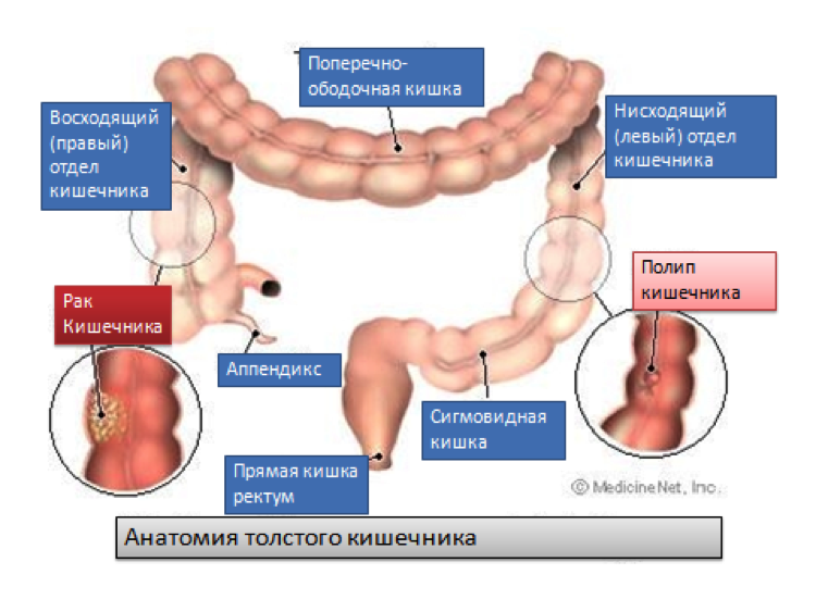 Полипы желудка: симптомы, диагностика и лечение. удаление полипа
