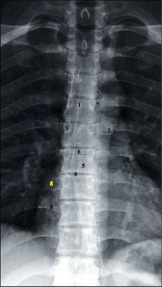 Рентген грудного отдела позвоночника в одинцово и звенигороде - цена