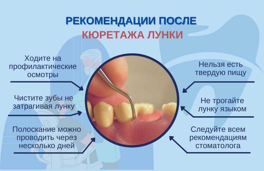 Удаление зуба: показания, противопоказания, удаление нерва и корня, рекомендации после удаления зуба
