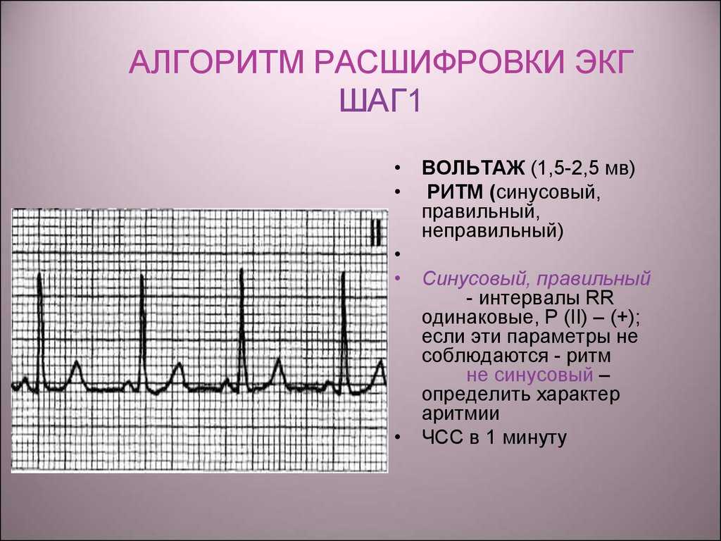 Экг – диагностика состояния сердца. показания к экг, что показывает исследование. как делают экг