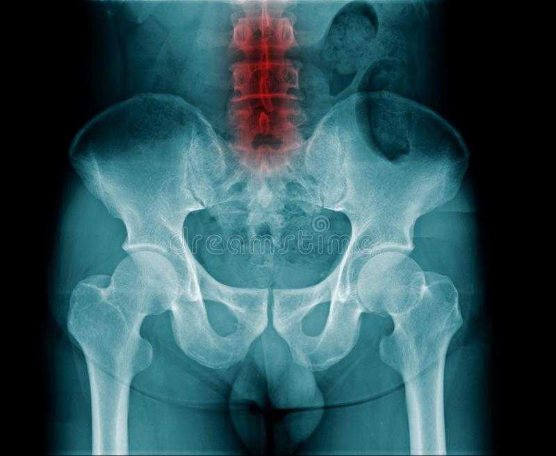 Рентген (рентгенография) костей таза: подготовка, проведение, результаты