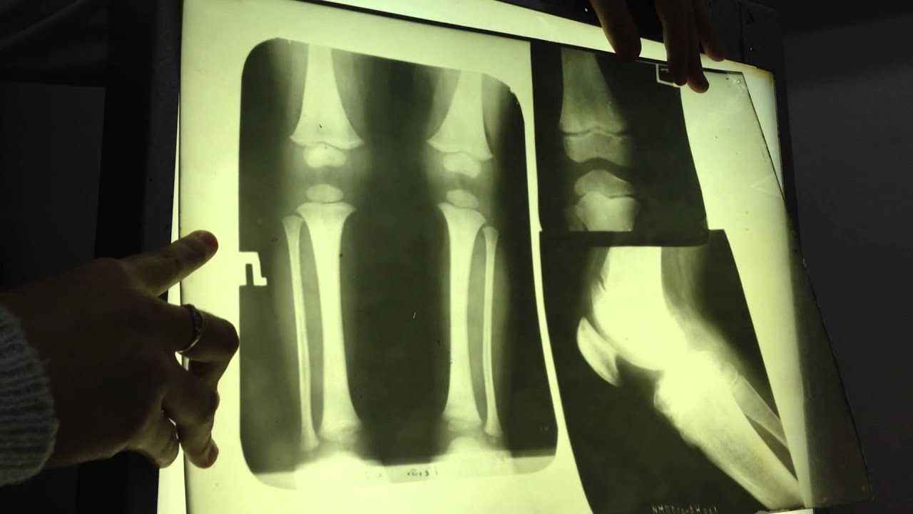 Рентген позвоночника: что показывает снимок и как подготовиться к диагностике?