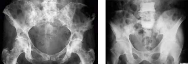 Рентген костей: виды рентгеновского исследования, методики исследования. показания и противопоказания