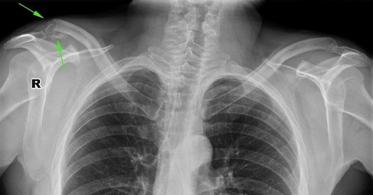 Доза облучения при рентгене, кт, мрт и узи: ну сколько можно? – напоправку