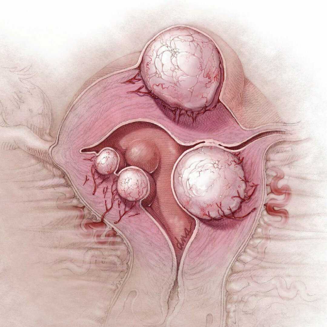 боли во время оргазма яичник фото 61
