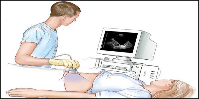 Узи органов малого таза у женщин: разновидности, предварительная подготовка, показания и последовательность проведения