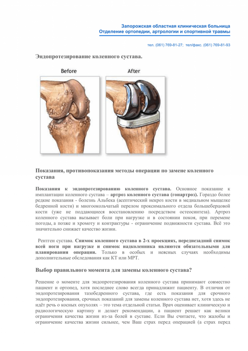 Замена сустава осложнения. Эндопротезирование коленного сустава. Операция тотального эндопротезирования коленного сустава. ТЭП эндопротезирование коленного сустава. Тотальное эндопротезирование коленного сустава схема операции.