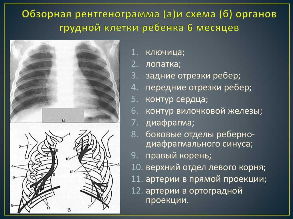 Что показывает рентген грудной клетки у взрослого - docdoc.ru
