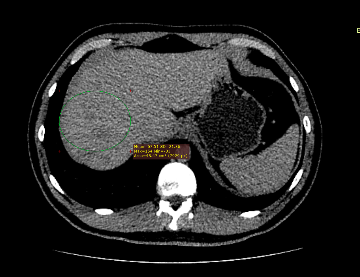 Компьютерная томография: подготовка к кт диагностики, отличие от мрт, как делают кт с контрастом