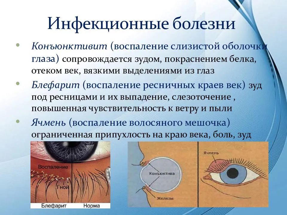 Нарушение глаза. Заболевания глаз список. Презентация заболевания глаз. Болезни глаз у человека список заболеваний.
