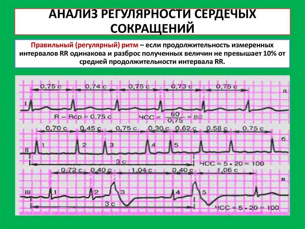 Основным методом оценки деятельности электрического водителя ритма сердца является