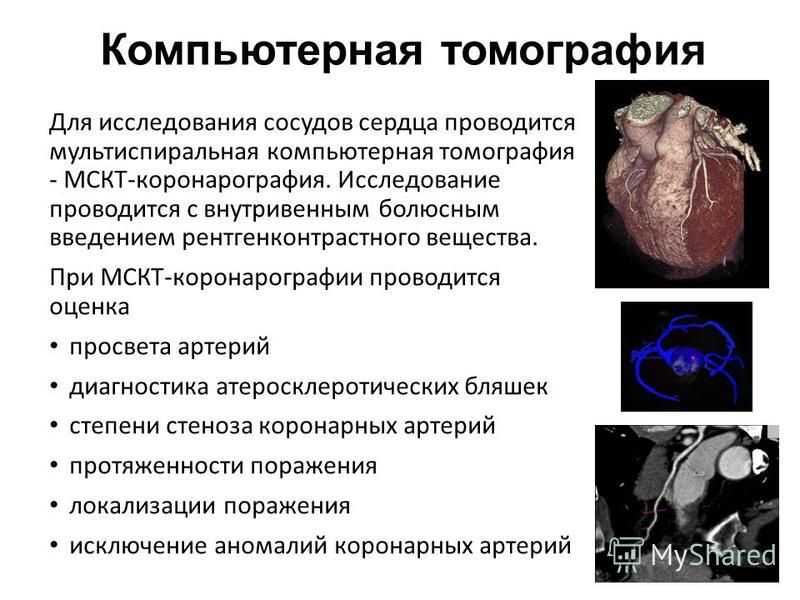 Мр-ангиография артерий головного мозга. показания и противопоказания к мр-ангиографии артерий головного мозга!