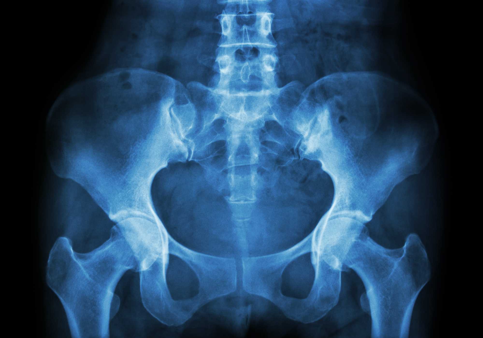 Суть, особенности методики и показания для назначения рентгена костей таза Подготовительный этапы и схема проведения рентгенографии для взрослых и детей
